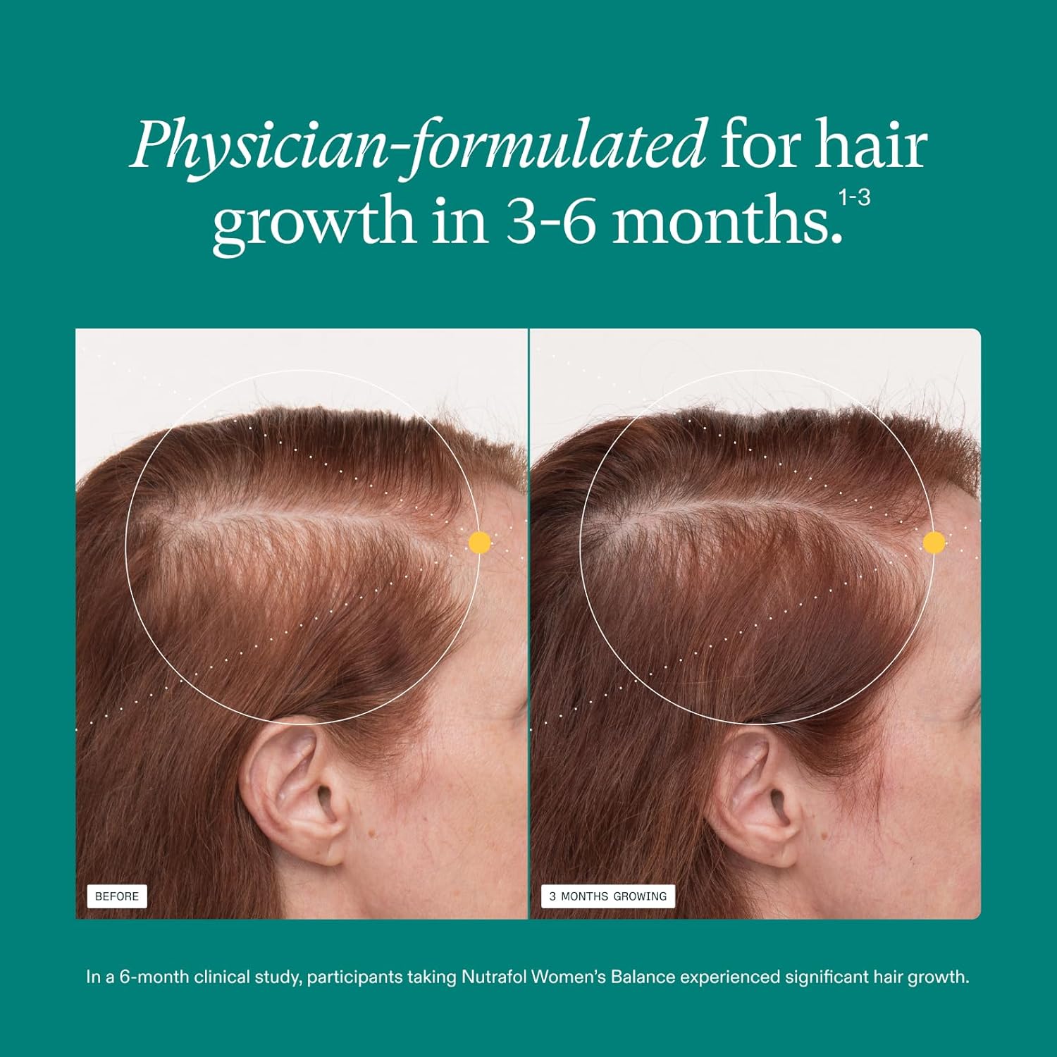 Women's Balance Hair Wellness Supplement for Ages 45+ – Supports Thicker Looking Hair & Scalp Care | 1 Month Supply