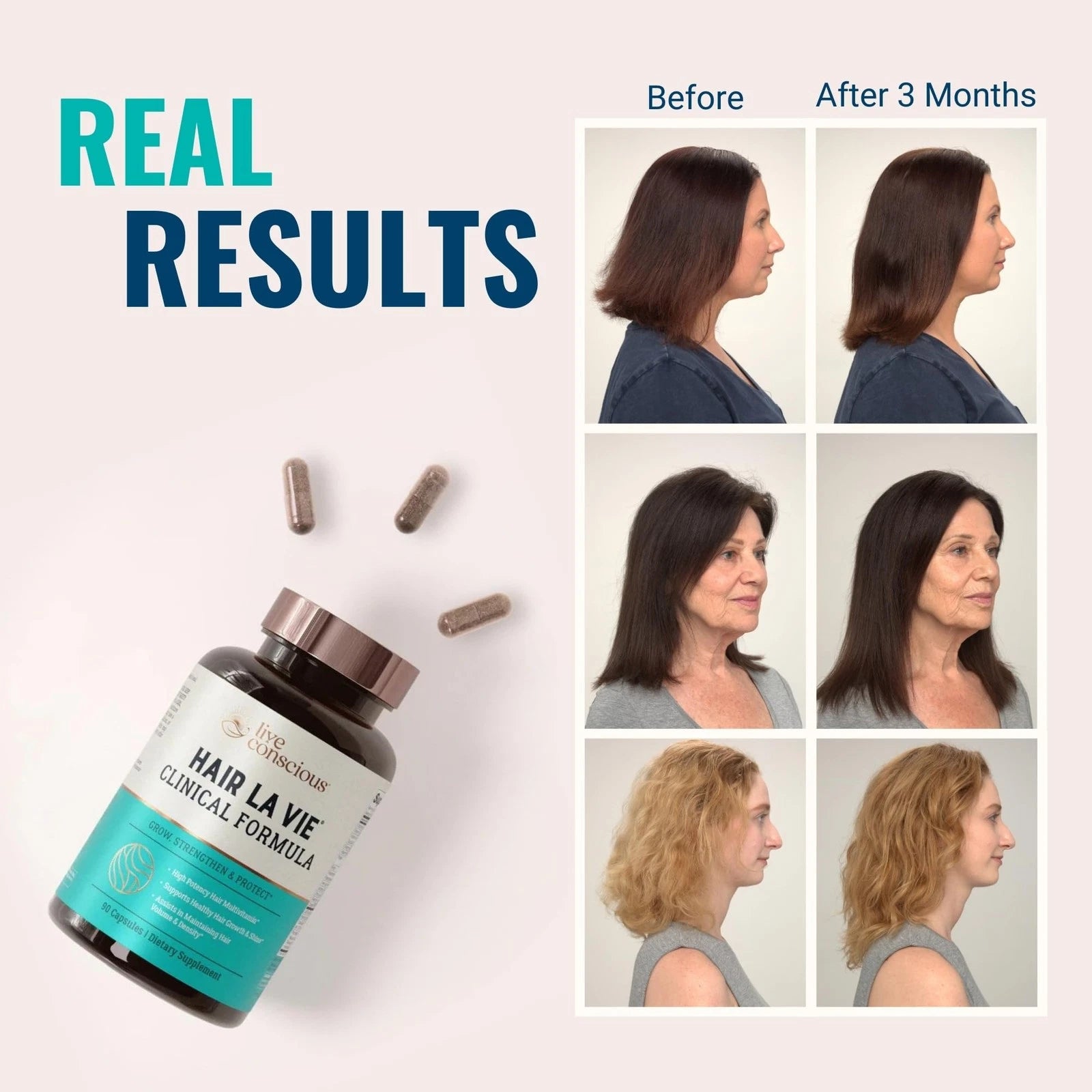 Hair La Vie Clinical Formula Hair Vitamins for Hair Regrowth, 90 Caps Pack of  3